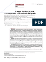 Interplay Between Prolactin and Pathogenesis of Psoriasis Vulgaris