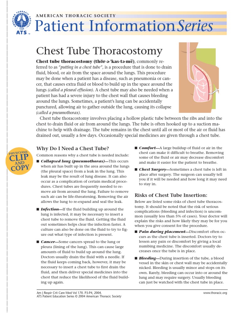 Chest Tube Thoracostomy Thorax Lung