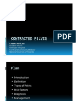 Contracted Pelvis by KABERA Rene