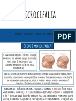 Microcefalia