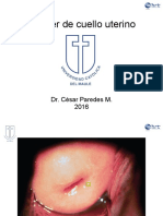 Ca Cervix PDF