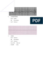 Irama: Ireguler HR: Tak Terhitung Gel P: Tidak Ada: Ventrikel Fibrilasi