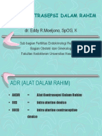 Alat Kontrasepsi Dalam Rahim - Eddy R Moeljono