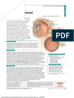 Retinal Detachment: Jama Patient Page