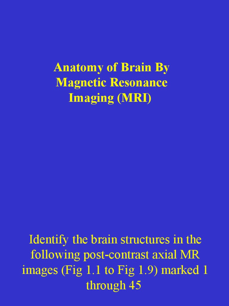 Brain MRI Structure Identification Guide | PDF | Organ (Anatomy ...