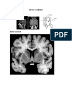 Cortes Cerebrales