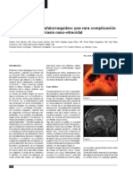 7 Neurocirugía 2014-Miasis - Nasoetmoidal PDF
