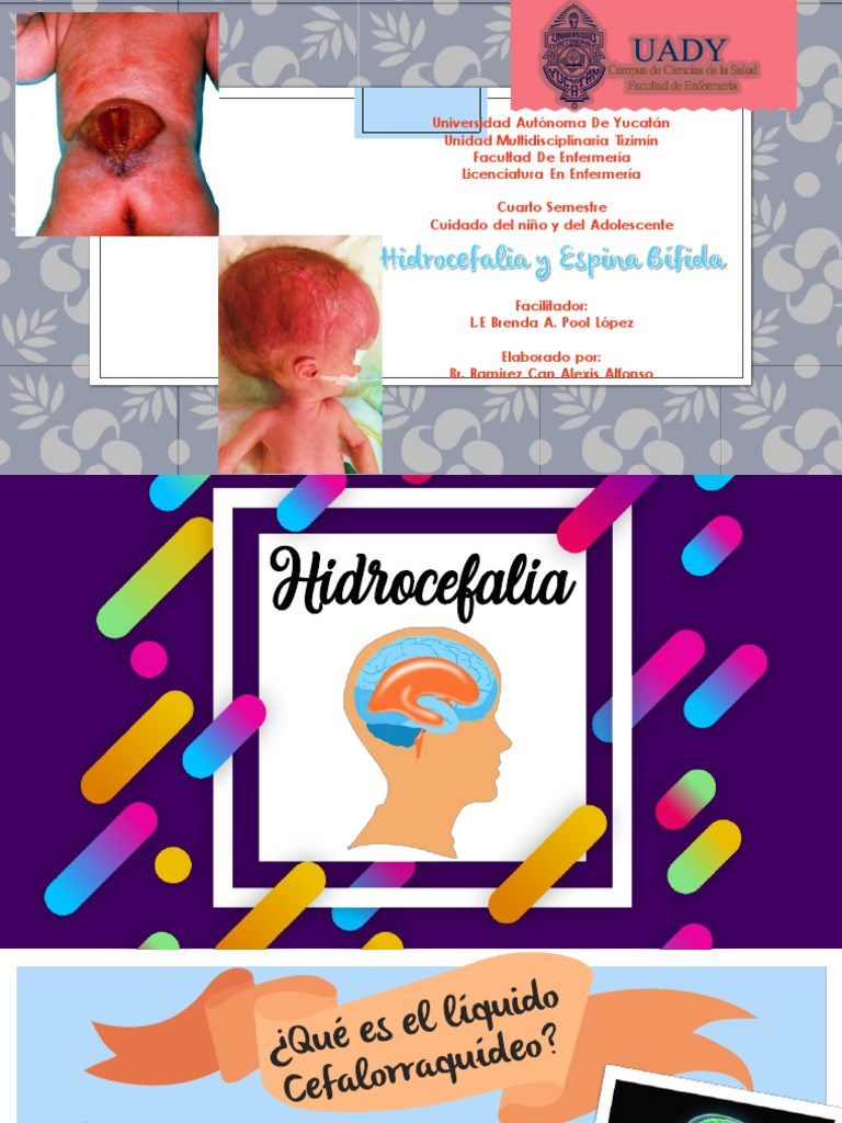 Hidrocefalia y Espina Bífida Presentación Fluido