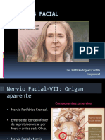 Parálisis Facial