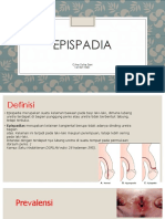 Epispadia 2