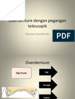 Overdenture Dengan Pegangan Telescopik