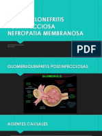 GLOMERULONEFRITIS POSTINFECCIOSA