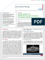 Primary Spindle Cell Rhabdomyosarcoma of Prostate