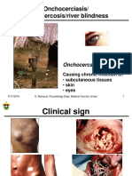 3 Tissue Helminth5 - Cutaneus Filariasis