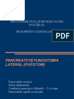 Procedimientos Quirurgicos Del Pancreas PDF