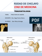 Frac cadera1.pptx