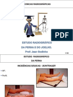 Radiografia da perna e joelho