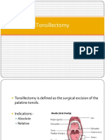 Tonsillectomy