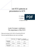 Different ECG Patterns at Presentation in ACS