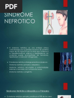 Sindrome Nefrotico