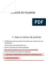 Cancer de Pulmon Essalud