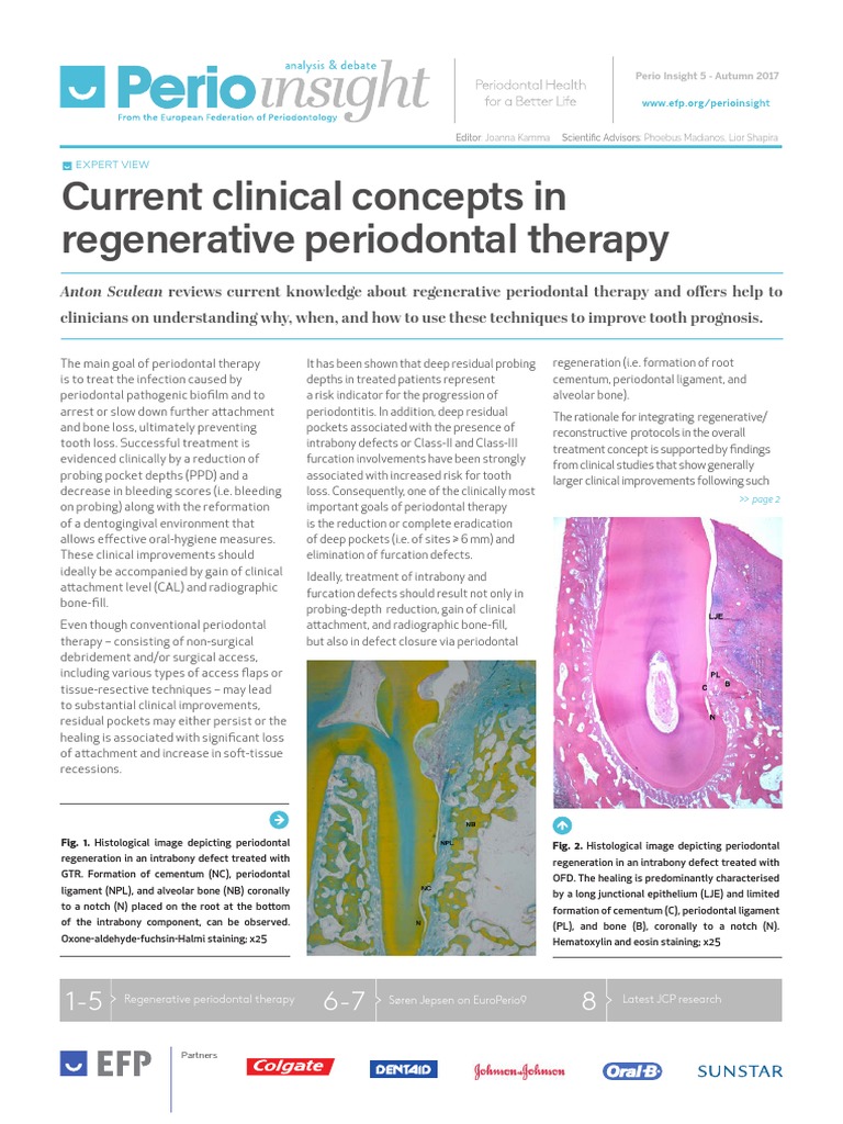 Current Clinical Concepts in Regenerative Periodontal Therapy PDF | PDF ...