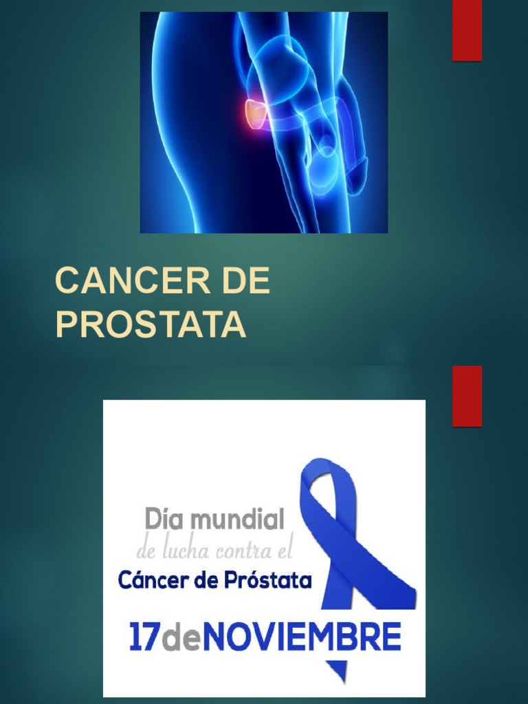 cancer de prostata ppt