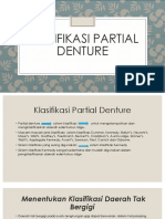 Klasifikasi Partial Denture