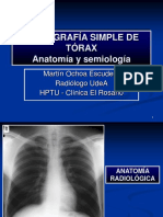 Radiografia Simple de Torax
