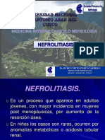 4) Nefrolitiasis