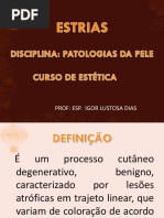 Aula 8 - Estrias