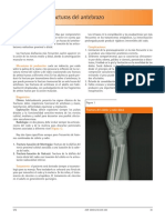 Fracturas del antebrazo: Diagnóstico y tratamiento