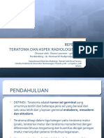 Referat Teratoma Radiologi REYNA