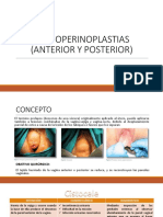 Colpoperinoplastias Anterior y Posterior