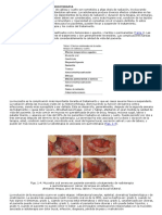 Efectos Colaterales de La Radioterapia