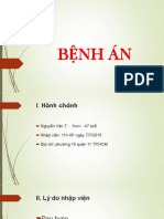 BA Bệnh Cơ Tim Giãn Nở