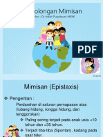 Penanganan Mimisan Pada Anak