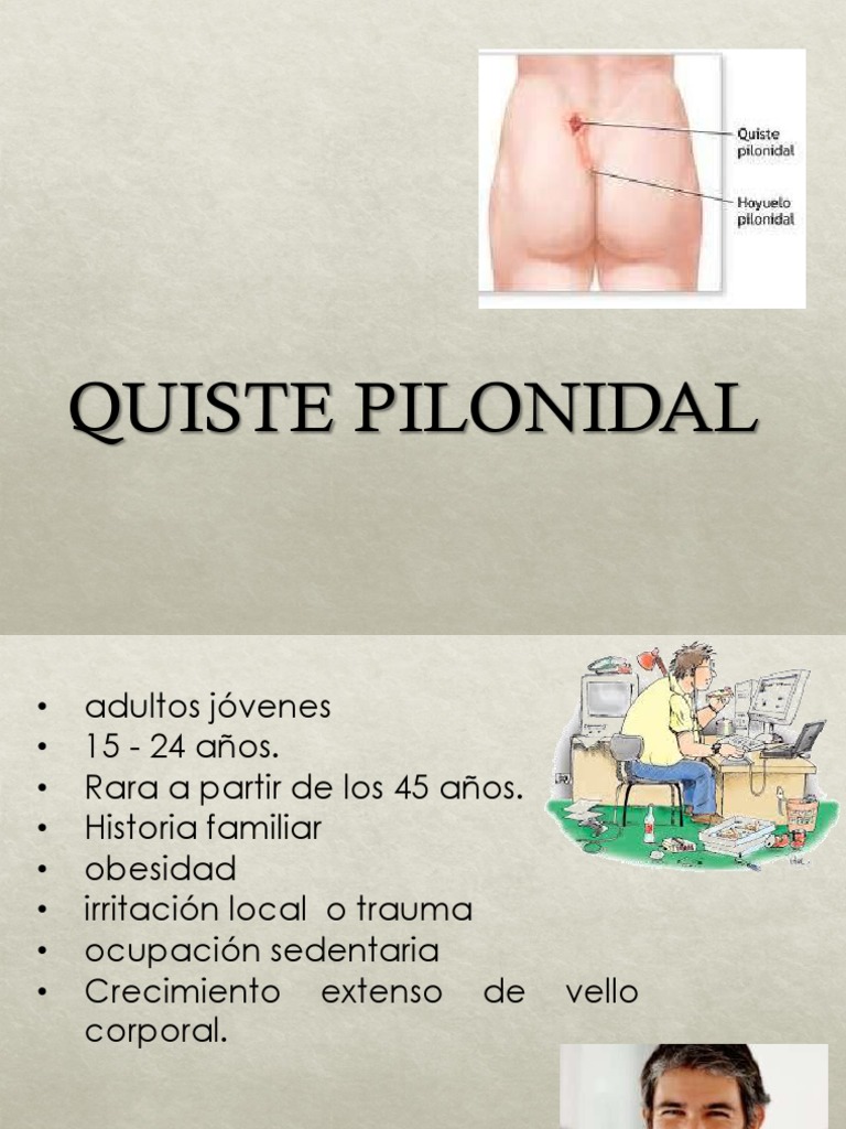 Tratamiento y síntomas del quiste pilonidal | PDF | Herida | Epidemiología