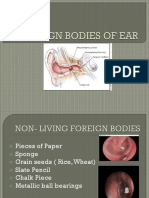 Foreign Bodies of Ear