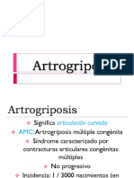 Artrogrifosis Cami