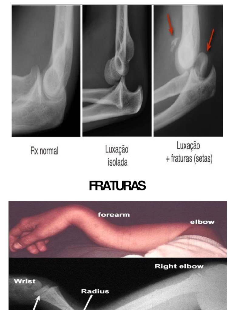 Estudos de Imagens Ortopédicas Fraturas Especialidades Médicas Medicina clínica