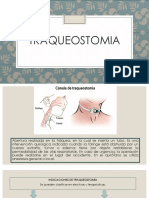 Ventilación Mecánica