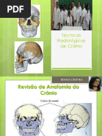 tecnicasdecranio-tabalhofaculdadeunig-121114175328-phpapp01.pdf