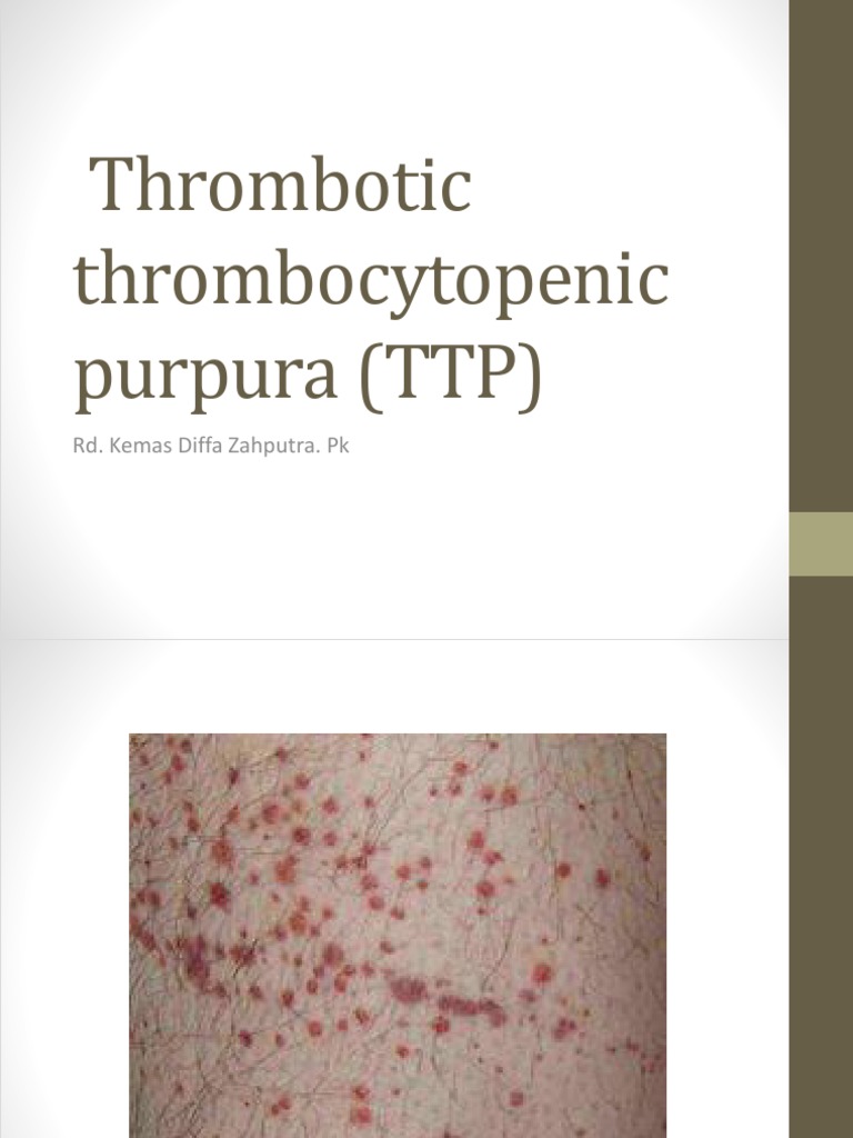 Overview of Thrombotic Thrombocytopenic Purpura | PDF