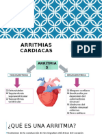 Arritmias Cardiacas 1