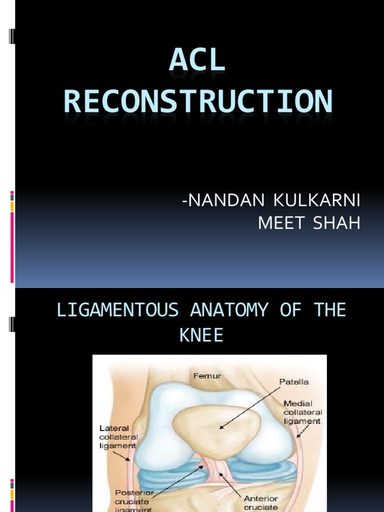 ACL Reconstruction | Download Free PDF | Knee | Lower Limb Anatomy