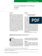 Diagnóstico electrocardiográfico de los síndromes coronarios agudos.pdf