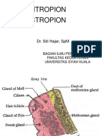 5 Entropion, Ektropion