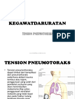 4. KEGAWATDARURATAN TENSION PNEUMOTORAKS.pptx