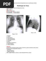 Radiologia Do Tórax